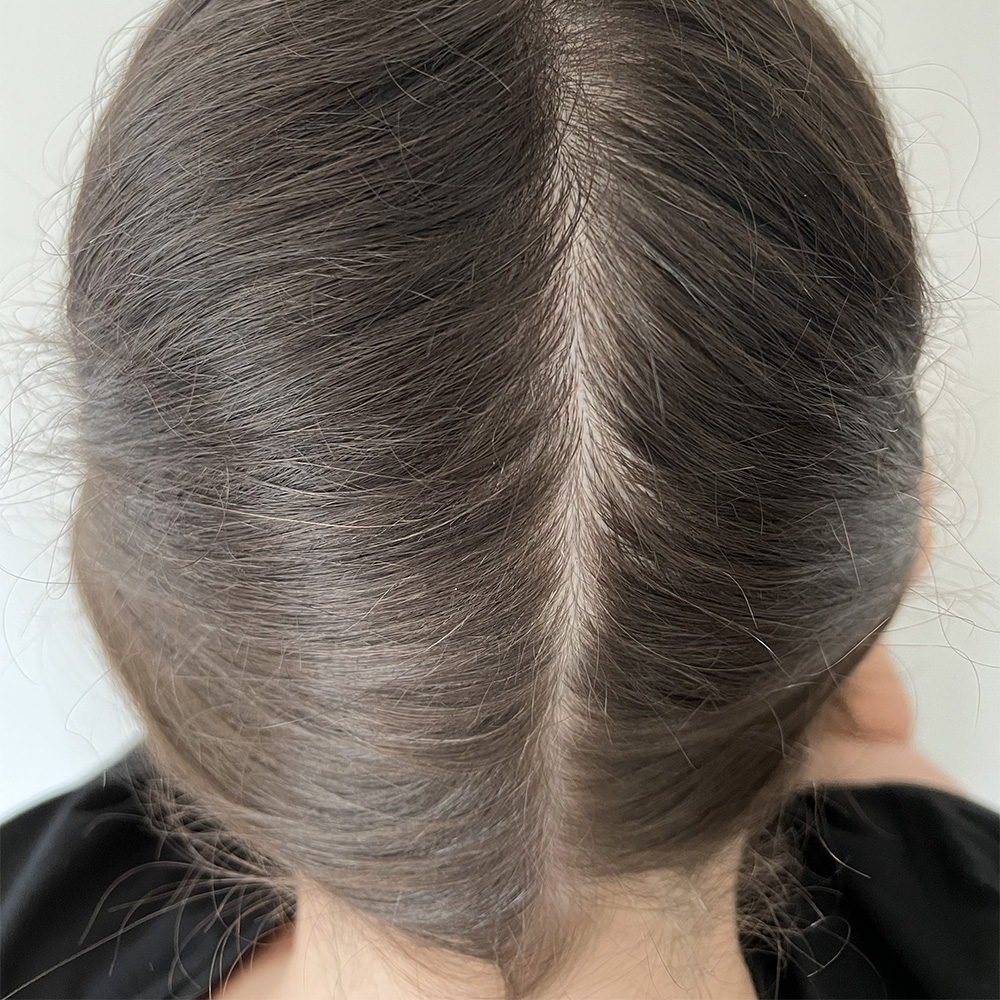 7. Back parting: