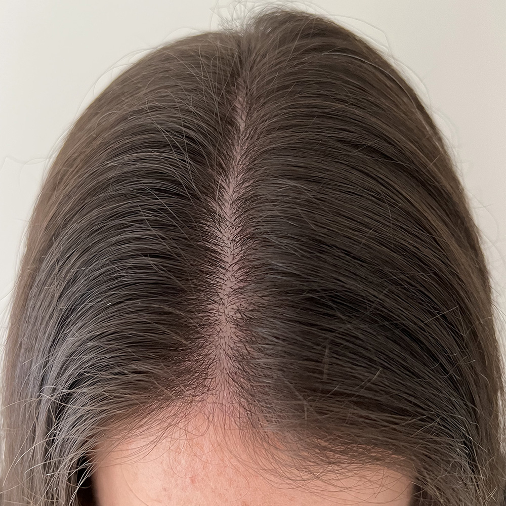 2.  Frontal parting: