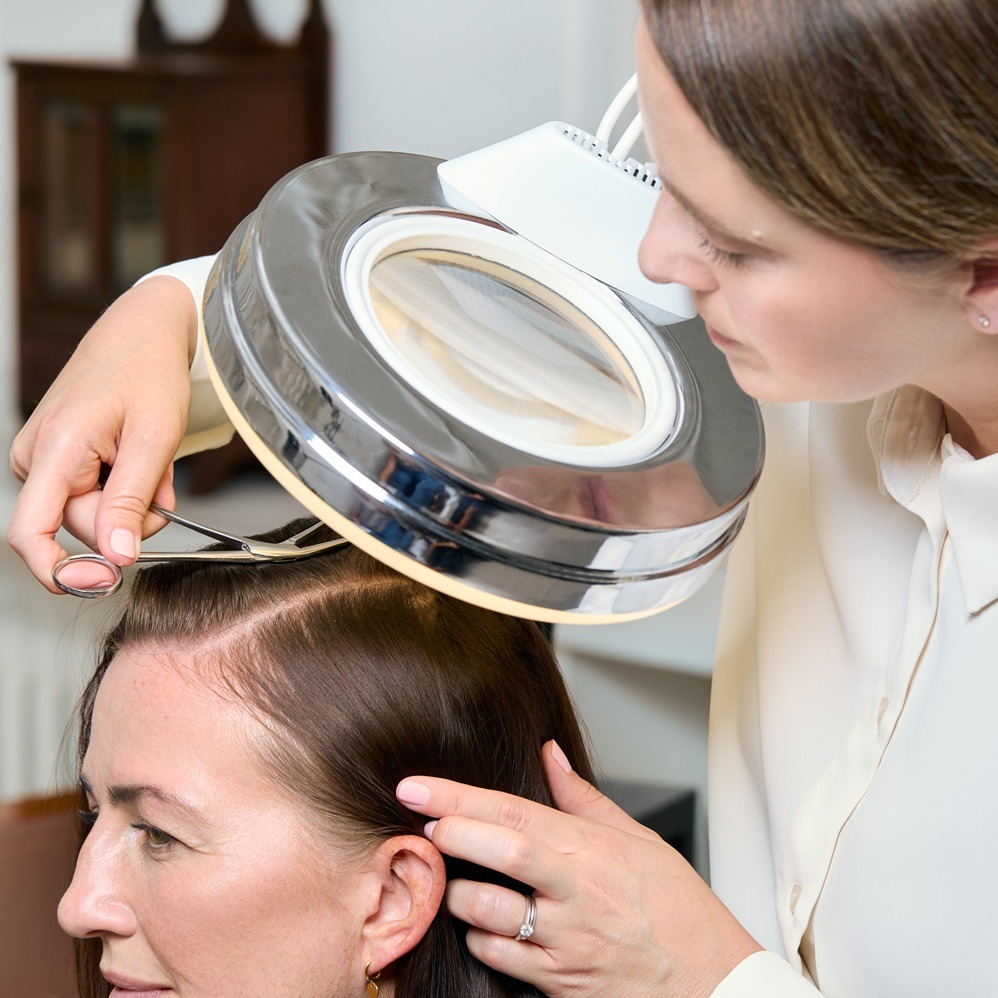 Female Hair Loss
