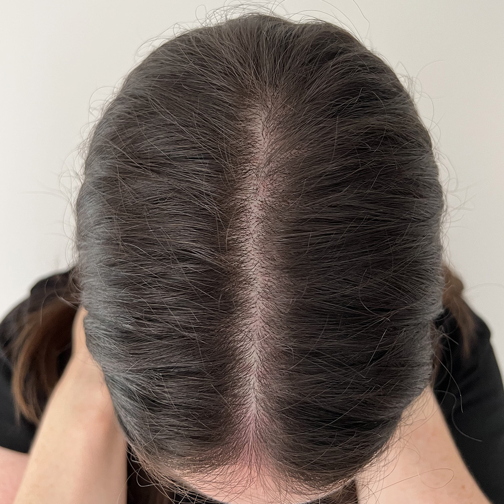 6. Top parting: